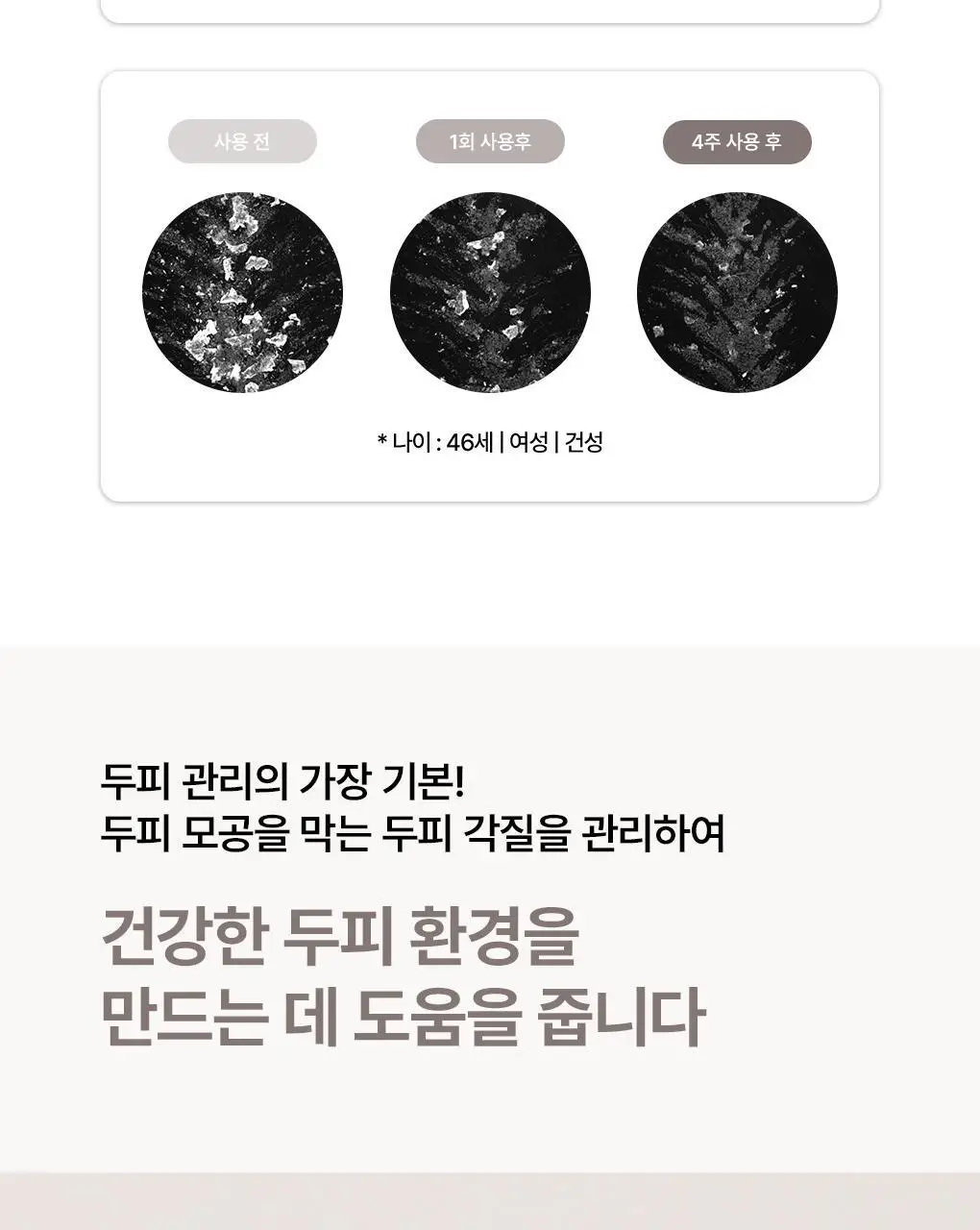 [비듬각질정화SET]라우쉬 콜츠푸트 안티-댄드러프 샴푸200ML&컨디셔너150ML 기획 상세페이지 11